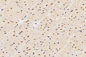 Immunohistochemistry analysis of paraffin-embedded rat heart using,TPRKB (ABIN7075943) at dilution of 1: 4200