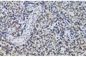 Immunohistochemistry of paraffin-embedded Human tonsil using TMPO Polyclonal Antibody at dilution of 1:100 (40x lens). (Thymopoietin anticorps)