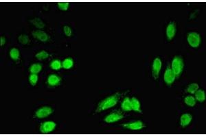 Immunofluorescent analysis of HepG2 cells using ABIN7142468 at dilution of 1:100 and Alexa Fluor 488-congugated AffiniPure Goat Anti-Rabbit IgG(H+L)