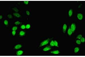 Immunofluorescent analysis of HepG2 cells using ABIN7142468 at dilution of 1:100 and Alexa Fluor 488-congugated AffiniPure Goat Anti-Rabbit IgG(H+L) (HPD anticorps  (AA 2-393))