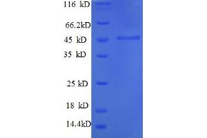 SDS-PAGE (SDS) image for Matrix Metallopeptidase 1 (Interstitial Collagenase) (MMP1) (AA 101-469), (partial) protein (His tag) (ABIN5712510)
