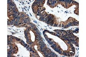 Immunohistochemical staining of paraffin-embedded liver tissue using anti-SRRmouse monoclonal antibody. (SRR anticorps)