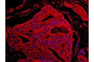 anti-BCL2-Associated Agonist of Cell Death (BAD) (AA 1-50) antibody
