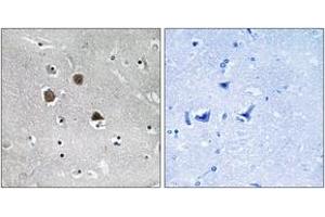 Immunohistochemistry analysis of paraffin-embedded human brain tissue, using MARK1/2/3/4 (Ab-215) Antibody.