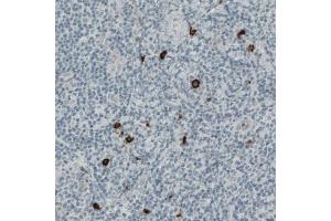 Immunohistochemical staining (Formalin-fixed paraffin-embedded sections) of human tonsil with KIT monoclonal antibody, clone CL1667  shows strong positivity in a subset of lymphoid cells. (KIT anticorps  (AA 50-190))