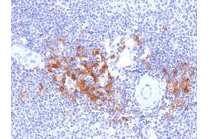 Formalin-fixed, paraffin-embedded human Spleen stained with TRAF1 Mouse Monoclonal Antibody (TRAF1/2770). (TRAF1 anticorps  (AA 73-219))