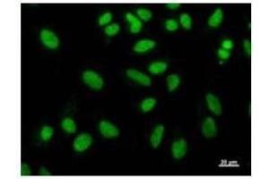 Immunostaining analysis in HeLa cells.