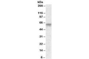 Western blot testing of human testis lysate with TTC8 antibody at 0. (TTC8 anticorps)