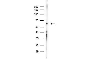 Western blot analysis of lysates from Hela cells(starvation,24h treatment), using Phospho-HDAC2 (Ser394) Antibody at 1/1000 dilution.