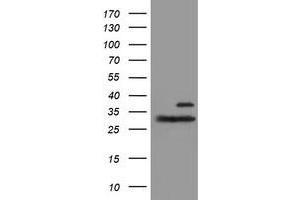 Western Blotting (WB) image for anti-Proteasome (Prosome, Macropain) Subunit, beta Type, 7 (PSMB7) (AA 58-277) antibody (ABIN1491600)