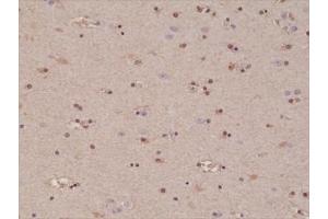 IHC testing of formalin fixed and paraffin embedded human brain tissue with recombinant S100B antibody at 1:1000 dilution.