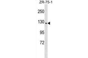 Western Blotting (WB) image for anti-Phosphatidylinositol Transfer Protein, Membrane-Associated 1 (PITPNM1) antibody (ABIN2999313)