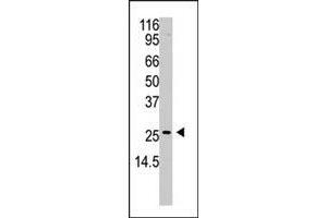 Western blot analysis of APH1A polyclonal antibody  in A2058 cell lysate (35 ug/lane). (APH1A anticorps  (N-Term))