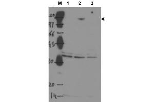 Image no. 1 for anti-Tumor Protein P53 Binding Protein 2 (TP53BP2) antibody (ABIN401045) (TP53BP2 anticorps)