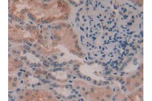 DAB staining on IHC-P; Samples: Human Kidney Tissue (AMBP anticorps  (AA 22-203))
