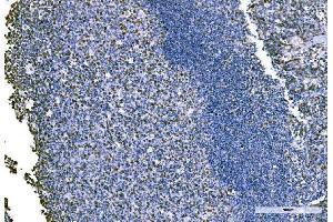 IHC analysis of KPNA2 using anti-KPNA2 antibody (ABIN7601936).