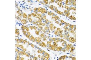 Immunohistochemistry of paraffin-embedded human stomach using POLG2 antibody (ABIN5974040) at dilution of 1/100 (40x lens). (POLG2 anticorps)