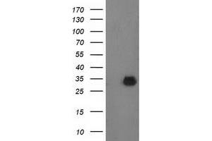Western Blotting (WB) image for anti-Phenylethanolamine N-Methyltransferase (PNMT) antibody (ABIN1500309) (PNMT anticorps)