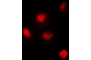 Immunofluorescent analysis of SUPT3H staining in MCF7 cells. (SUPT3H/SPT3 anticorps  (Center))