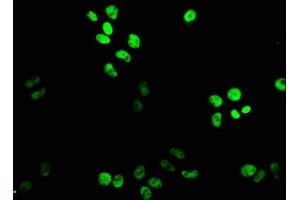 Immunofluorescence staining of PC-3 cells with ABIN7164186 at 1:133, counter-stained with DAPI. (XAB2 anticorps  (AA 750-840))