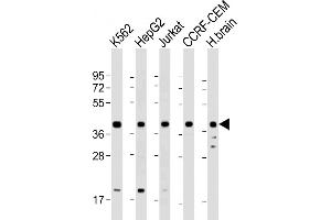 All lanes : Anti-Cyclophilin D Antibody at 1:2000 dilution Lane 1: K562 whole cell lysate Lane 2: HepG2 whole cell lysate Lane 3: Jurkat whole cell lysate Lane 4: CCRF-CEM whole cell lysate Lane 5: human brain lysate Lysates/proteins at 20 μg per lane. (PPID anticorps  (AA 336-370))