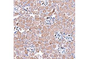IHC analysis of p57 Kip2/CDKN1C using anti-p57 Kip2/CDKN1C antibody (ABIN7603232). (CDKN1C anticorps  (N-Term))