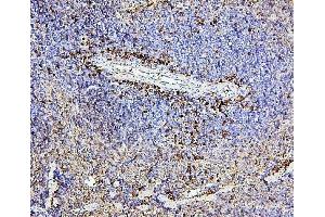 IHC analysis of CD43 using anti-CD43 antibody (ABIN7601042). (CD43 anticorps  (AA 272-400))