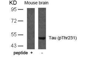 Western blot analysis of extracts from mouse brain tissue using Tau(Phospho-Thr231) Antibody and the same antibody preincubated with blocking peptide. (MAPT anticorps  (pThr231))