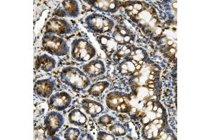 IHC analysis of Hexokinase 1/HK1 using anti-Hexokinase 1/HK1 antibody (ABIN7600259).