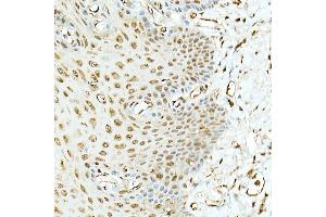 Immunohistochemistry of paraffin-embedded rat liver using DNA Ligase III/LIG3 Rabbit pAb (ABIN6130288, ABIN6143207, ABIN6143208 and ABIN6217532) at dilution of 1:50 (40x lens).