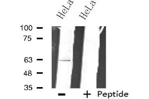 Western blot analysis of extracts from HeLa cells, using ZNF18 antibody. (ZNF18 anticorps  (C-Term))