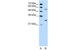 WB Suggested Anti-PDPK1 Antibody Titration: 0. (PDPK1 anticorps  (Middle Region))