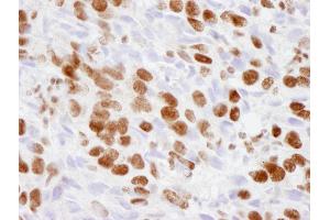Immunohistochemistry (IHC) image for anti-E1A Binding Protein P300 (EP300) (AA 950-1000) antibody (ABIN7448706)