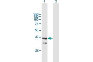 Western Blot analysis of AGMAT expression in transfected 293T cell line by AGMAT MaxPab polyclonal antibody. (AGMAT anticorps  (AA 1-352))
