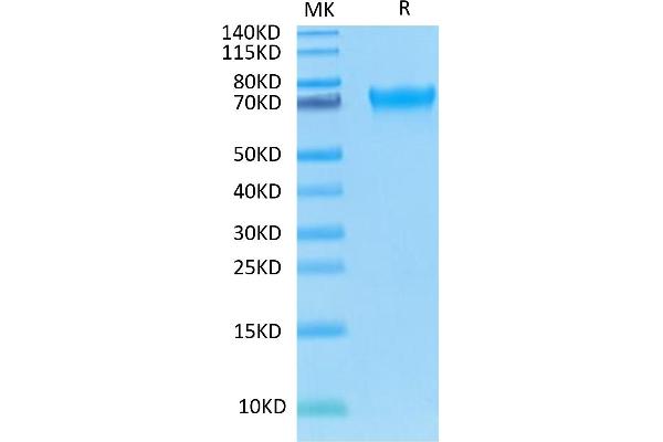LILRA6 Protein (AA 24-447) (His-Avi Tag)