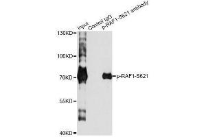 Immunoprecipitation analysis of 200 μg extracts of HeLa cells treated by EGF using 2. (RAF1 anticorps  (pSer621))