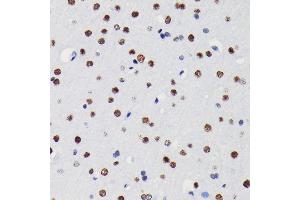 Immunohistochemistry of paraffin-embedded Mouse brain using HD antibody (ABIN7267707) at dilution of 1:100 (40x lens).