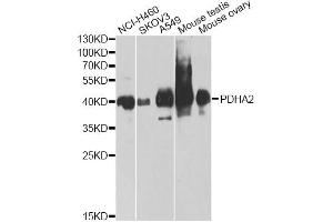 Western blot analysis of extracts of various cell lines, using PDHA2 antibody. (PDHA2 anticorps)