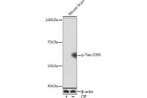 Western blot analysis of extracts of Mouse brain, using Phospho-Tau-S396 Rabbit mAb (ABIN7268523) at 1:1000 dilution. (MAPT anticorps  (pSer396))