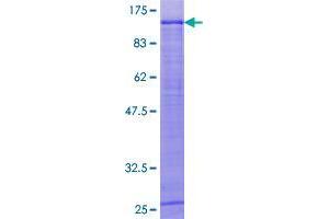 Image no. 1 for ElaC Homolog 2 (ELAC2) (AA 1-826) protein (GST tag) (ABIN1352660)