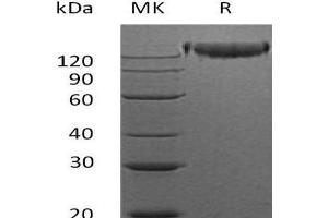 Western Blotting (WB) image for Sema Domain, Immunoglobulin Domain (Ig), Transmembrane Domain (TM) and Short Cytoplasmic Domain, (Semaphorin) 4D (SEMA4D) protein (Fc Tag) (ABIN7320711)