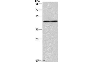 Western blot analysis of Mouse heart tissue, using IL5RA Polyclonal Antibody at dilution of 1:550 (IL5RA anticorps)