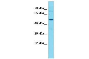 Host:  Rabbit  Target Name:  Zbtb7c  Sample Type:  Mouse Brain lysates  Antibody Dilution:  1. (ZBTB7C anticorps  (Middle Region))