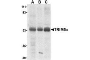 Western blot analysis of TRIM5 alpha expression in human stomach (A), thymus (B), and uterus (C) cell lysate with this product at 2 μg /ml. (TRIM5 anticorps  (Isoform alpha, Middle Region))
