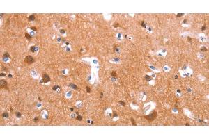 Immunohistochemistry of paraffin-embedded Human brain tissue using GAS8 Polyclonal Antibody at dilution 1:40 (GAS8 anticorps)