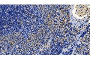 Detection of TGFb1 in Rat Spleen Tissue using Polyclonal Antibody to Transforming Growth Factor Beta 1 (TGFb1)