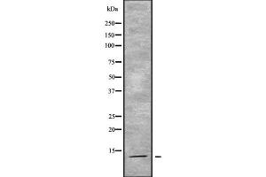 Western blot analysis of ACYP2 using K562 whole cell lysates