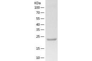 Western Blotting (WB) image for Insulin-Like Growth Factor 2 mRNA Binding Protein 2 (IGF2BP2) (AA 1-220) protein (His tag) (ABIN7123455)