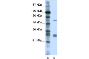WB Suggested Anti-LRRC14 Antibody Titration:  0. (LRRC14 anticorps  (C-Term))