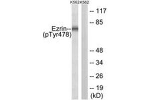 Image no. 1 for anti-Ezrin (EZR) (AA 446-495), (pTyr478) antibody (ABIN1532010) (Ezrin anticorps  (pTyr478))